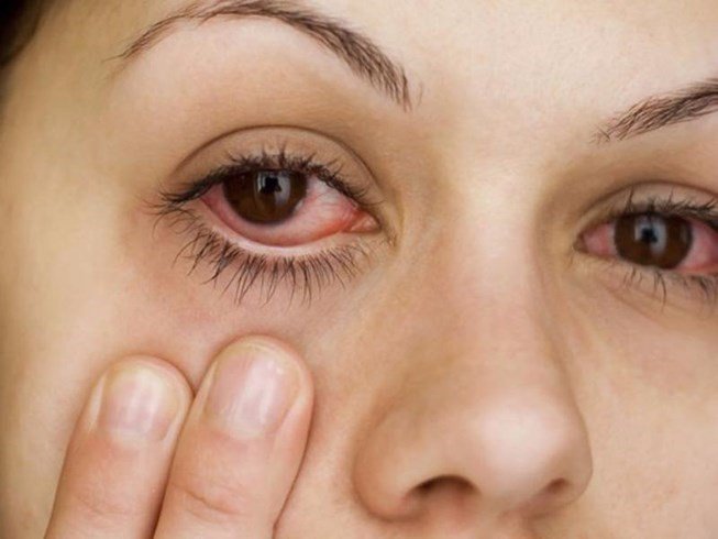 Người ngoài 60 tuổi cần chăm sóc mắt như thế nào? - 3