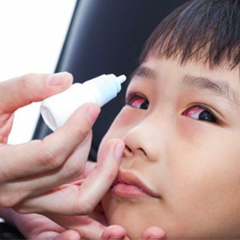 Nhỏ thuốc nhỏ mắt cho trẻ 